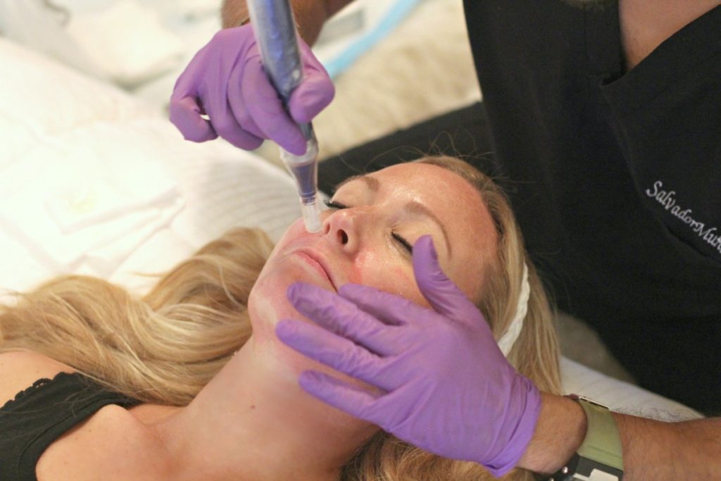 SkinPen Microneedling