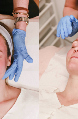 Fall Beauty: Glytone M&M Facial